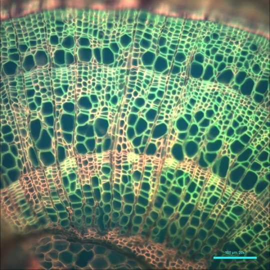 Tila stem auto-fluorescence on LS620 3-color fluorescence microscope