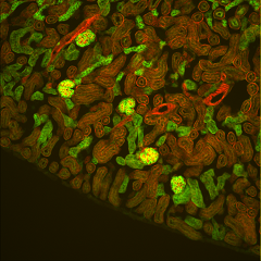 Mouse kidney stained to show glomerular tubules (green) & filimentous actin (red)