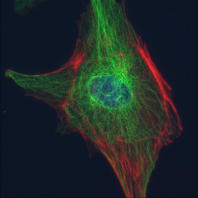 DNA, alpha-tubulin, & F-actin in BPAE cells                                