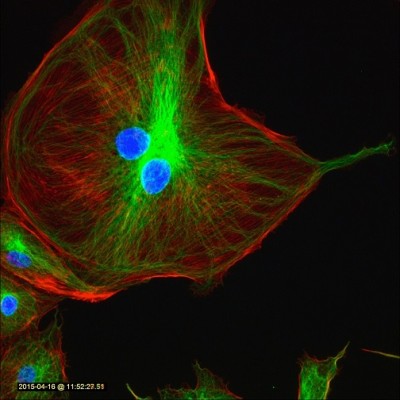 DNA, alpha-tubulin, & F-actin in BPAE cells                                