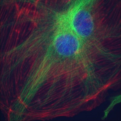 DNA, alpha-tubulin, & F-actin in BPAE cells                                