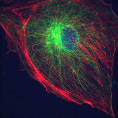 DNA, alpha-tubulin, & F-actin in BPAE cells                                