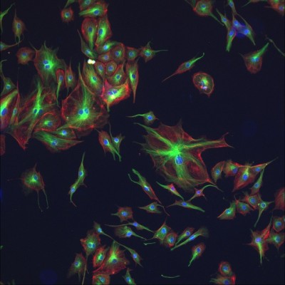 DNA, alpha-tubulin, & F-actin in BPAE cells                                