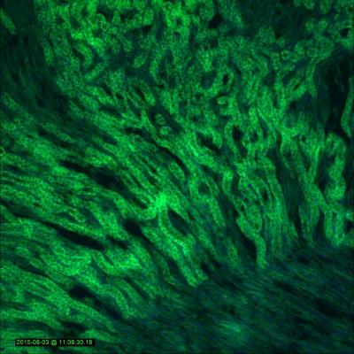 Glomeruli & convoluted tubules in mouse kidney                                  