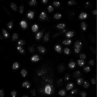 RNA FISH z-max 