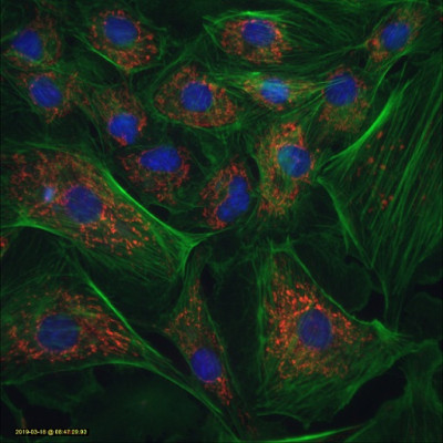 Red mitochondria                              
