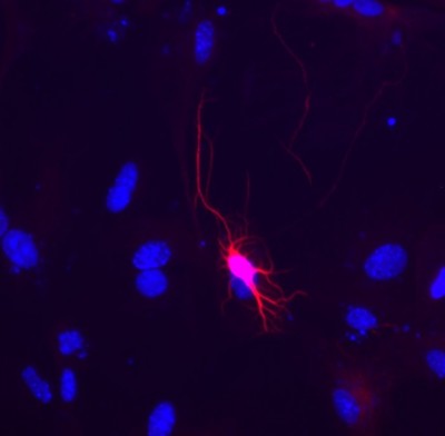 Mouse neural stem cell       